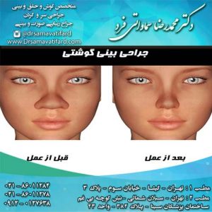 جراحی بینی گوشتی