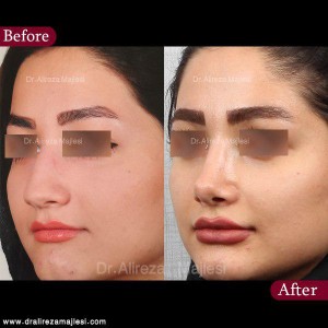 جراح بینی اصفهان