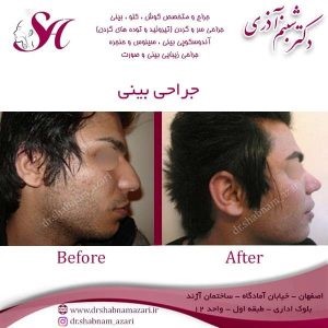 جراح بینی اصفهان