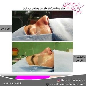 جراح بینی شیراز