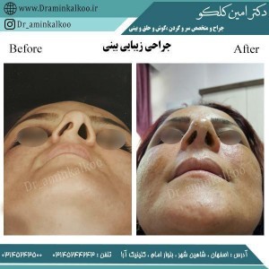 جراح بینی اصفهان