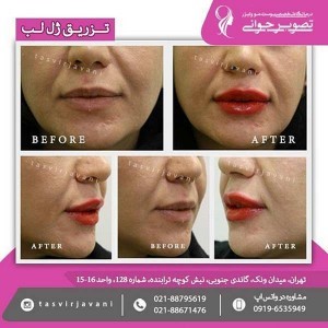 بهترین کلینیک زیبایی تهران