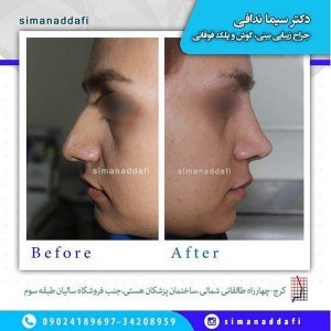 جراح بینی کرج