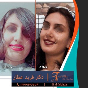 جراح بینی کرج