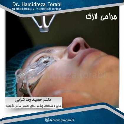 جراحی لازک